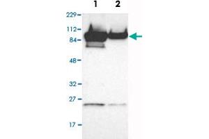 Western Blot analysis of Lane 1: RT-4 and Lane 2: U-251MG sp cell lysates with AKAP8 polyclonal antibody . (AKAP8 Antikörper)