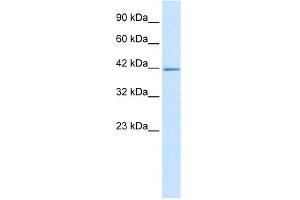 WB Suggested Anti-ZNFN1A2 Antibody Titration: 5. (IKZF2 Antikörper  (C-Term))