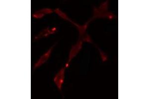 Immunofluorescence (fixed cells) (IF/ICC) image for anti-Polymerase (DNA Directed), delta 1, Catalytic Subunit 125kDa (POLD1) (C-Term) antibody (ABIN6258118)