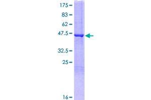 FGF16 Protein (AA 1-207) (GST tag)