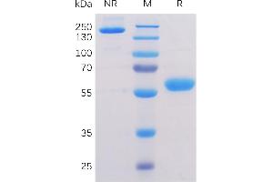 SDS-PAGE (SDS) image for Butyrophilin, Subfamily 3, Member A1 (BTN3A1) (AA 30-254) protein (mFc-His Tag) (ABIN6961119)