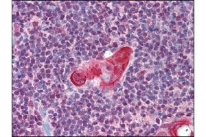 Image no. 1 for anti-T-Cell Leukemia Homeobox 1 (TLX1) (AA 300-330) antibody (ABIN372448) (TLX1 Antikörper  (AA 300-330))