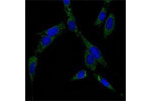 Immunofluorescence analysis of NIH/3T3 cells using HSP70 mouse mAb (green). (HSP70 Antikörper)