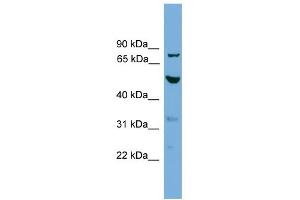 WB Suggested Anti-TUBA8 Antibody Titration: 0.