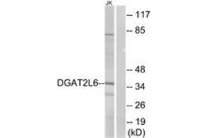 Western blot analysis of extracts from Jurkat cells, using DGAT2L6 Antibody. (DGAT2L6 Antikörper  (AA 271-320))