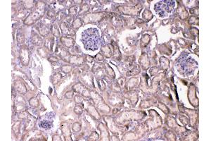 IHC analysis of VEGF Receptor 2 using anti-VEGF Receptor 2 antibody . (VEGFR2/CD309 Antikörper  (AA 20-244))