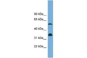 WB Suggested Anti-CYP26B1 Antibody Titration: 0. (CYP26B1 Antikörper  (Middle Region))