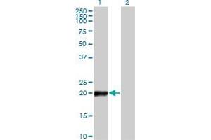 Western Blot analysis of COPS8 expression in transfected 293T cell line by COPS8 monoclonal antibody (M04), clone 2G8.