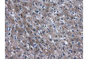 Image no. 1 for anti-V-Akt Murine Thymoma Viral Oncogene Homolog 2 (AKT2) antibody (ABIN1496564) (AKT2 Antikörper)