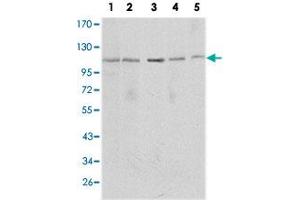 Western blot analysis using SIRT1 monoclonal antobody, clone 1F3  against MCF-7 (1), Jurkat (2), HeLa (3), HEK293 (4) and A-549 (5) cell lysate.