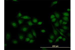 Immunofluorescence of monoclonal antibody to KDM5B on HeLa cell.