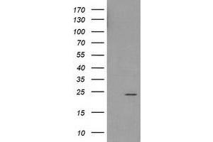 Western Blotting (WB) image for anti-Haloacid Dehalogenase-Like Hydrolase Domain Containing 1 (HDHD1) antibody (ABIN1498624) (HDHD1 Antikörper)