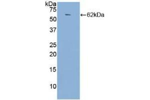 Western blot analysis of recombinant Human ACE. (Angiotensin I Converting Enzyme 1 Antikörper  (AA 814-1071))