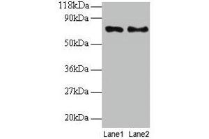 Western blot All lanes: TAX1BP3 antibody at 2 μg/mL Lane 1: EC109 whole cell lysate Lane 2: 293T whole cell lysate Secondary Goat polyclonal to rabbit IgG at 1/15000 dilution Predicted band size: 14 kDa Observed band size: 70 kDa (TAX1BP3 Antikörper  (AA 1-124))