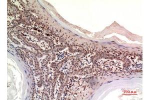 Immunohistochemistry (IHC) analysis of paraffin-embedded Human Skin, antibody was diluted at 1:100. (NOV Antikörper  (Internal Region))