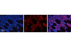 Rabbit Anti-NR4A2 Antibody   Formalin Fixed Paraffin Embedded Tissue: Human Bone Marrow Tissue Observed Staining: Cytoplasm Primary Antibody Concentration: 1:600 Other Working Concentrations: N/A Secondary Antibody: Donkey anti-Rabbit-Cy3 Secondary Antibody Concentration: 1:200 Magnification: 20X Exposure Time: 0. (NR4A2 Antikörper  (C-Term))