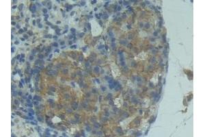 Detection of FASL in Rat Pancreas Tissue using Polyclonal Antibody to Factor Related Apoptosis Ligand (FASL) (FASL Antikörper  (AA 100-278))