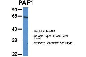 Host: Rabbit  Target Name: PAF1  Sample Tissue: Human Fetal Heart  Antibody Dilution: 1. (PAF1/PD2 Antikörper  (N-Term))