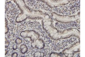 Immunoperoxidase of monoclonal antibody to MEF2A on formalin-fixed paraffin-embedded human small Intestine. (MEF2A Antikörper  (AA 71-170))