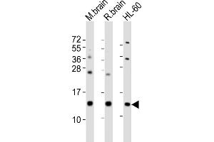 All lanes : Anti-FKBP1A Antibody (Center) at 1:2000 dilution Lane 1: mouse brain lysates Lane 2: rat brain lysates Lane 3: HL-60 whole cell lysates Lysates/proteins at 20 μg per lane. (FKBP1A Antikörper  (AA 34-68))
