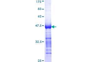 TESK2 Protein (AA 405-542) (GST tag)