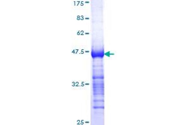 TESK2 Protein (AA 405-542) (GST tag)