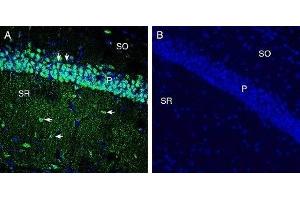 Immunohistochemistry (IHC) image for anti-Solute Carrier Family 7, (Cationic Amino Acid Transporter, Y+ System) Member 11 (SLC7A11) (AA 218-231), (Extracellular) antibody (ABIN7043751)