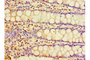 Immunohistochemistry of paraffin-embedded human rectum tissue using CHRFAM7A Antibody at a dilution of 1:100. (CHRFAM7A Antikörper  (AA 1-150))