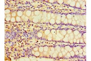 Immunohistochemistry (Paraffin-embedded Sections) (IHC (p)) image for anti-CHRNA7 (Cholinergic Receptor, Nicotinic, alpha 7, Exons 5-10) and FAM7A (Family with Sequence Similarity 7A, Exons A-E) Fusion (CHRFAM7A) (AA 1-150) antibody (ABIN6098837)