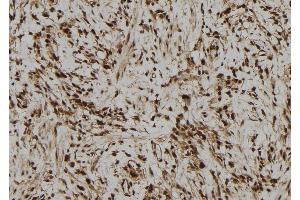 ABIN6278875 at 1/100 staining Human gastric tissue by IHC-P.