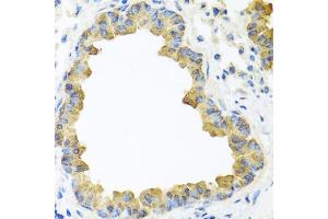 Immunohistochemistry of paraffin-embedded mouse lung using WNT5B antibody (ABIN5974661) at dilution of 1/100 (40x lens). (WNT5B Antikörper)