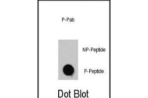 Dot blot analysis of anti-TSC2-p Phospho-specific Pab (R) on nitrocellulose membrane.