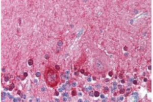 Immunohistochemistry (IHC) image for anti-Potassium Large Conductance Calcium-Activated Channel, Subfamily M, alpha Member 1 (KCNMA1) (Internal Region) antibody (ABIN1048988)