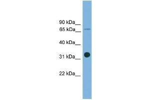 WB Suggested Anti-SLC5A4 Antibody Titration: 0. (SLC5A4 Antikörper  (Middle Region))