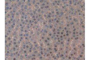 DAB staining on IHC-P; Samples: Rat Liver Tissue (TOP2 Antikörper  (AA 1079-1328))