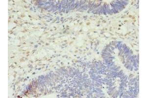 Immunohistochemistry (IHC) image for anti-serine/threonine Kinase 38 Like (STK38L) (AA 212-464) antibody (ABIN7169003)