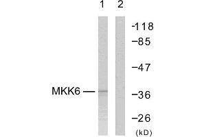 Western Blotting (WB) image for anti-Mitogen-Activated Protein Kinase Kinase 3 (MAP2K3) (Ser207) antibody (ABIN1848130)