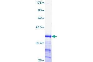Image no. 1 for Cyclin E1 (CCNE1) (AA 311-410) protein (GST tag) (ABIN1348461)