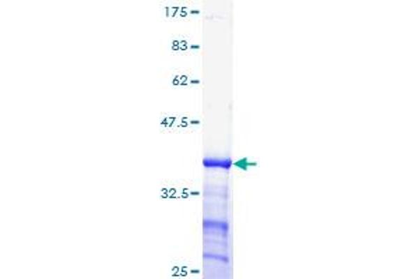Cyclin E1 Protein (CCNE1) (AA 311-410) (GST tag)