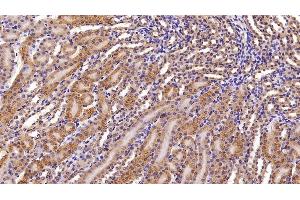 Immunohistochemistry (IHC) image for anti-Apolipoprotein M (APOM) (AA 8-188) antibody (ABIN7434803)