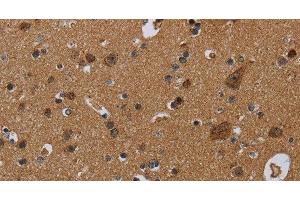 Immunohistochemistry (Paraffin-embedded Sections) (IHC (p)) image for anti-NADH Dehydrogenase (Ubiquinone) Fe-S Protein 8, 23kDa (NADH-Coenzyme Q Reductase) (NDUFS8) antibody (ABIN7241747)