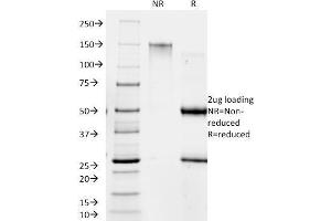SDS-PAGE Analysis Purified RANK Giardia lamblia Mouse Monoclonal Antibody (BB1. (Giardia Lamblia Antikörper)