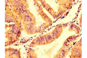 Immunohistochemistry (IHC) image for anti-ATP-Binding Cassette, Sub-Family C (CFTR/MRP), Member 8 (ABCC8) (AA 729-838) antibody (ABIN7144904)