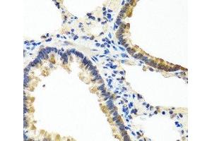 Immunohistochemistry of paraffin-embedded Rat lung using ANGPT1 Polyclonal Antibody at dilution of 1:100 (40x lens). (Angiopoietin 1 Antikörper)