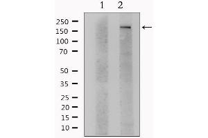 Western blot analysis of extracts from Hela, using ITGAM Antibody. (CD11b Antikörper  (Internal Region))