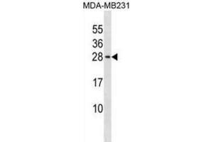 Western Blotting (WB) image for anti-Peptidyl Prolyl Cis/Trans Isomerase NIMA Interacting 4 Protein (PIN4) antibody (ABIN3000322) (PIN4 Antikörper)