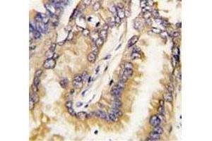 Immunohistochemistry (IHC) image for anti-BH3 Interacting Domain Death Agonist (BID) (AA 68-103) antibody (ABIN3028508)