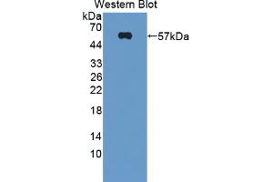 Western blot analysis of the recombinant protein. (Dysferlin Antikörper  (AA 1-479))