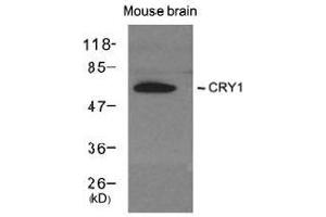 Western blot analysis of extracts from Mouse brain tissue using CRY1 antibody (CRY1 Antikörper  (AA 551-555))