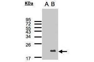 WB Image Western Blot analysis of UBE2C expression in transfected 293T cell line by UBE2C polyclonal antibody. (UBE2C Antikörper)